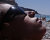 Deadly Skin Cancer More Common in the UK